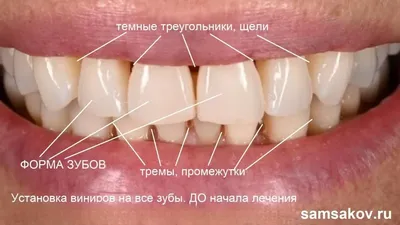 Цвет Зубов А1 Фото – Telegraph