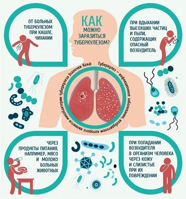 Туберкулез картинки