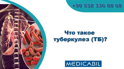 Туберкулез: легких, кожи, костей, пр; симптомы и лечение