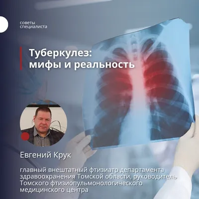 Всемирный день борьбы с туберкулезом - Республиканское унитарное  предприятие «Молодечненский центр стандартизации, метрологии и сертификации»