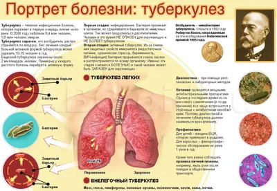 Туберкулез. Заболевания.