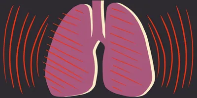 7 ранних симптомов туберкулёза, которые нельзя пропустить - Лайфхакер
