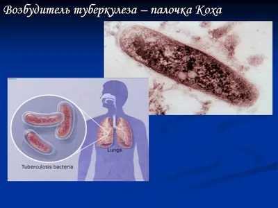Лечение и профилактика туберкулеза у домашних животных в клинике Аист-вет,  г. Одинцово
