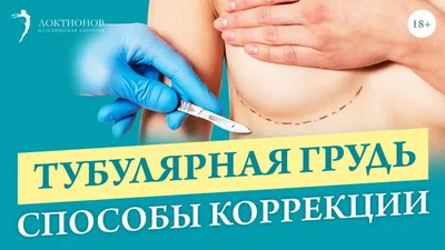Увеличение груди - Маммопластика в Волгограде