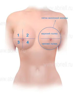 Тубулярная грудь: как исправить ⭐