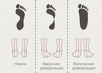 Энциклопедия - Стопа
