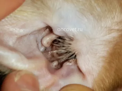 Краевая себорея ушных раковин