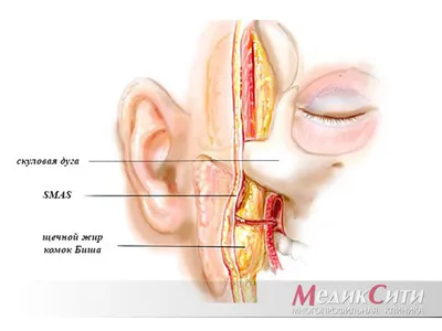 Удаление комков Биша по цене от 39 900 руб. в медицинском центре  «Номосклиник» | Пластика лица в Москве
