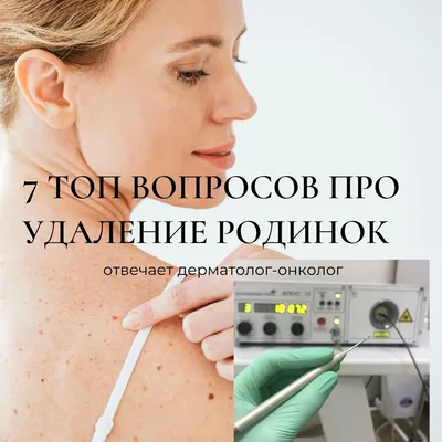 Лазерное удаление новообразований: цена от 349 рублей за единицу в Москве |  Удаление новообразований лазером в клинике BeautyWay Clinic