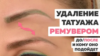 Удаление татуажа бровей Revivink в Москве, цены – лазерное удаление  перманентного макияжа в салоне красоты