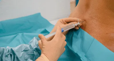 Идеальный укол: ученые нашли способ экономить вакцину от COVID-19 | Статьи  | Известия