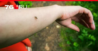 Лучшие средства от зуда после укусов комаров и других насекомых - 6 июля  2021 - 76.ru