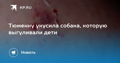 Суд взыскал с мэрии Благовещенска штраф за бездомную собаку, покусавшую  несовершеннолетнего | 02.05.2023 | Благовещенск - БезФормата