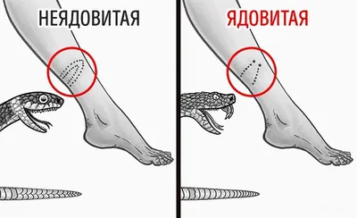 Дружочек Ветклиника - Теплая зима повлекла за собой очень активный сезон  клещей.Таких \"красавцев\" снимаем каждый день. И по этому хотим напомнить  Вам что клещи очень опасны! .‼️Пироплазмоз собак – это заболевание, которое