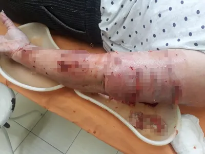 Собака напала на женщину в Рудном | Новости города Рудного |  Интернет-портал Город