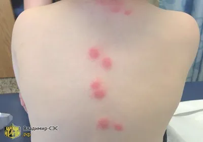 Кусаются ли тараканы и чем ещё они могут быть опасны - Лайфхакер