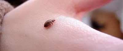 Укусы постельных клопов у детей: опасность, симптомы и где можно заразиться