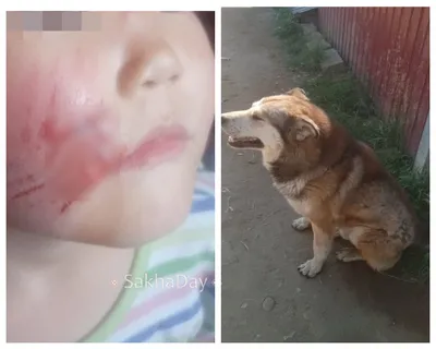 Укусила собака и палец опух»: жительница Новосибирска не смогла снять  кольцо и вызвала спасателей - KP.RU