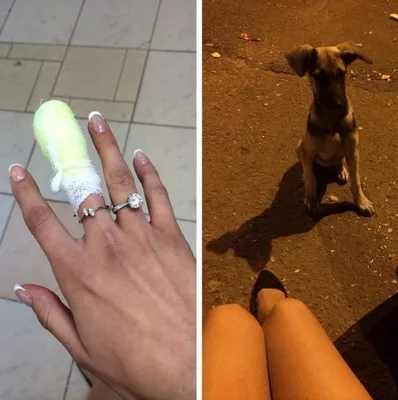 В Саратове бездомная собака укусила за лицо 15-летнюю школьницу - Газета.Ru  | Новости