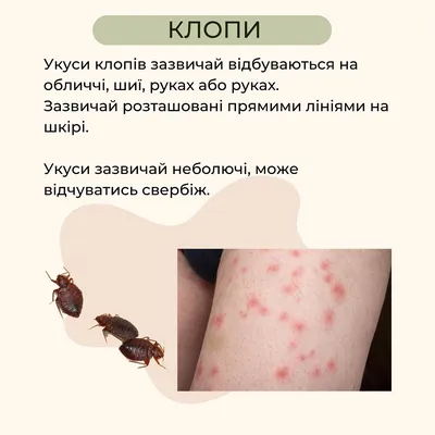 Самые страшные укусы насекомых — в голову, шею и область грудной клетки.  Как вести себя и что делать до приезда скорой помощи? | Климовичи. Новости  города и района.