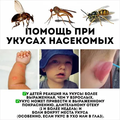 Почему укусы муравьев так болят🧐 #факты #образован... ᐈ memorynews  (@memorynews) | Yappy