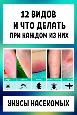 Инсектная аллергия - на укусы насекомых — Алёна Парецкая на TenChat.ru