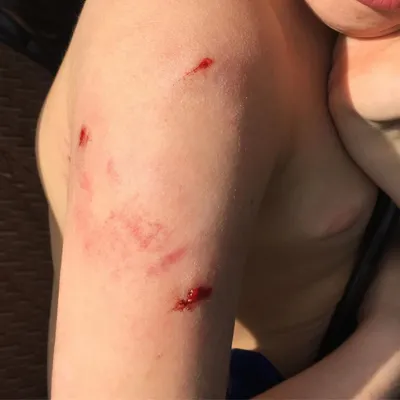 На Большой Горной гулявшую с двухлетним сыном женщину покусала собака |  22.02.2022 | Саратов - БезФормата