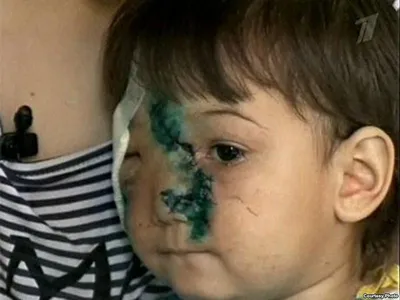 После нападения собак два часа не могли успокоить ребенка, теперь до  сентября дочери предстоит сделать пять уколов» — LipetskMedia