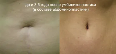 пластическая хирургия Линк | пластическая хирургия в корее | Корейская  дерматология