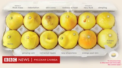 Как лимоны помогают распознавать ранние признаки рака груди - BBC News  Русская служба