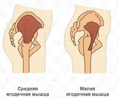 Упражнения для укрепления мышц спины | Блог о здоровье