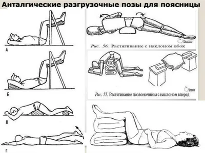 S-Образный сколиоз 1-2-3 степени, причины, лечение грудо-поясничного отдела  позвоночника