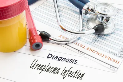 Уреаплазмоз у мужчин: симптомы и лечение уреаплазмы