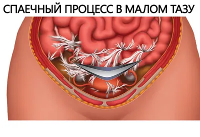 Лечение хламидиоза, уреаплазмоза и микоплазмоза. | Он-Лайн Клиник |  Медицинский центр в Красноярске
