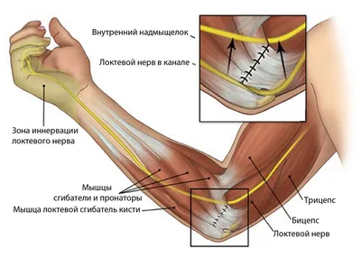 Лучезапястный сустав — Википедия