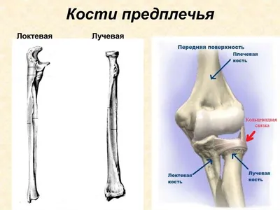 Синдром кубитального канала (синдром сдавления локтевого нерва) — Травмаорто