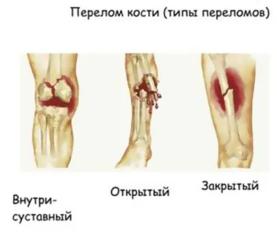 Травматические повреждения и заболевания локтевого сустава