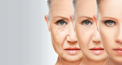 Косметологическая клиника \"Модерм Косметик\" - Сегодня мы хотим познакомить  Вас с одним из четырёх типов старения кожи. Усталый тип старения или просто  «усталое лицо». Признаки: ➖снижение мышечного тонуса ➖опущение уголков глаз  и