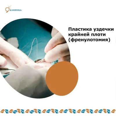 Урология Запорожье - Уздечка полового члена - это небольшая эластичная  складка кожи, соединяющая головку с листком крайней плоти. Её повреждение  обычно сопровождается резкими болями и кровотечением. ❓При каких ситуациях  возможен разрыв❓ ✔️Грубый