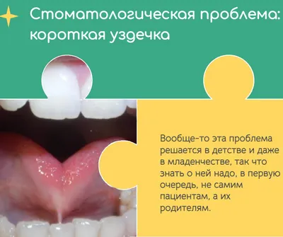Лучшие мази для лечения баланопостита у мужчин: рейтинг топ-10 эффективных  и недорогих средств по версии КП