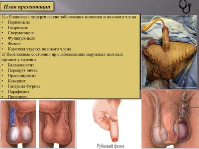 Лечение короткой уздечки языка в клинике | НоваДент