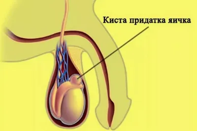 Прыщи на половом члене - виды, причины, диагностика и лечение | Клиника  МедПросвет
