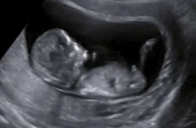 Теория черепа эмбриона: миф или реальность?