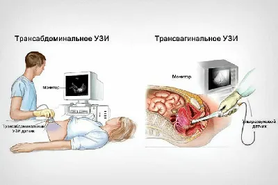 УЗИ органов малого таза | Сделать ультразвуковую диагностику матки в «ЦЕНТР  МЕДИЦИНЫ ТРУДА» в Серпухове