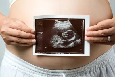УЗИ беременности на ранних сроках: цена - GM Clinica