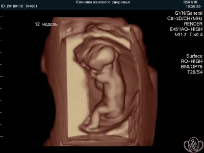 УЗИ детям - цена, сделать ультразвуковое исследование ребенку в клинике  «Мать и дитя» в Уфе