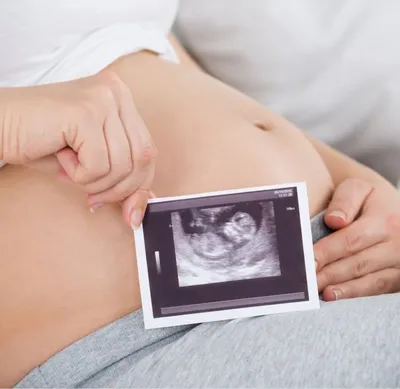 УЗИ на ранних сроках беременности | Центр медицины плода