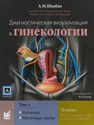 Диагностическая визуализация в гинекологии Том 2 | Шаабан А. М. - купить с  доставкой по выгодным ценам в интернет-магазине OZON (320925431)