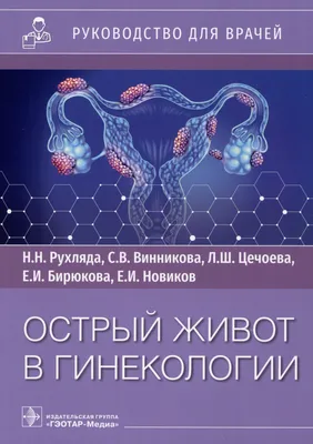 Острый живот в гинекологии: руководство для врачей (Симона Винникова,  Николай Рухляда, Лейла Цечоева) - купить книгу с доставкой в  интернет-магазине «Читай-город». ISBN: 978-5-97-047826-4