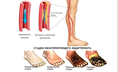 АНАТОМИЯ ДЕТСКОЙ СТОПЫ ВАЛЬГУСНАЯ ДЕФОРМАЦИЯ СТОПЫ У ДЕТЕЙ | Foot Station